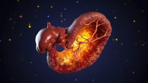 תסמונת המעי הרגיז